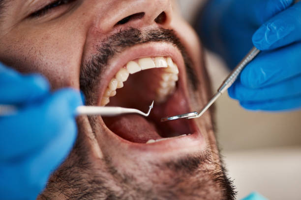 Best Chipped Tooth Repair Near Me  in Rutherford, PA